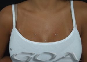 dermal_anchors_by_franz_nieto_20130412_1871229699-300x246