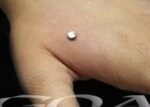 dermal_anchors_by_franz_nieto_20130412_2025988766-150x150